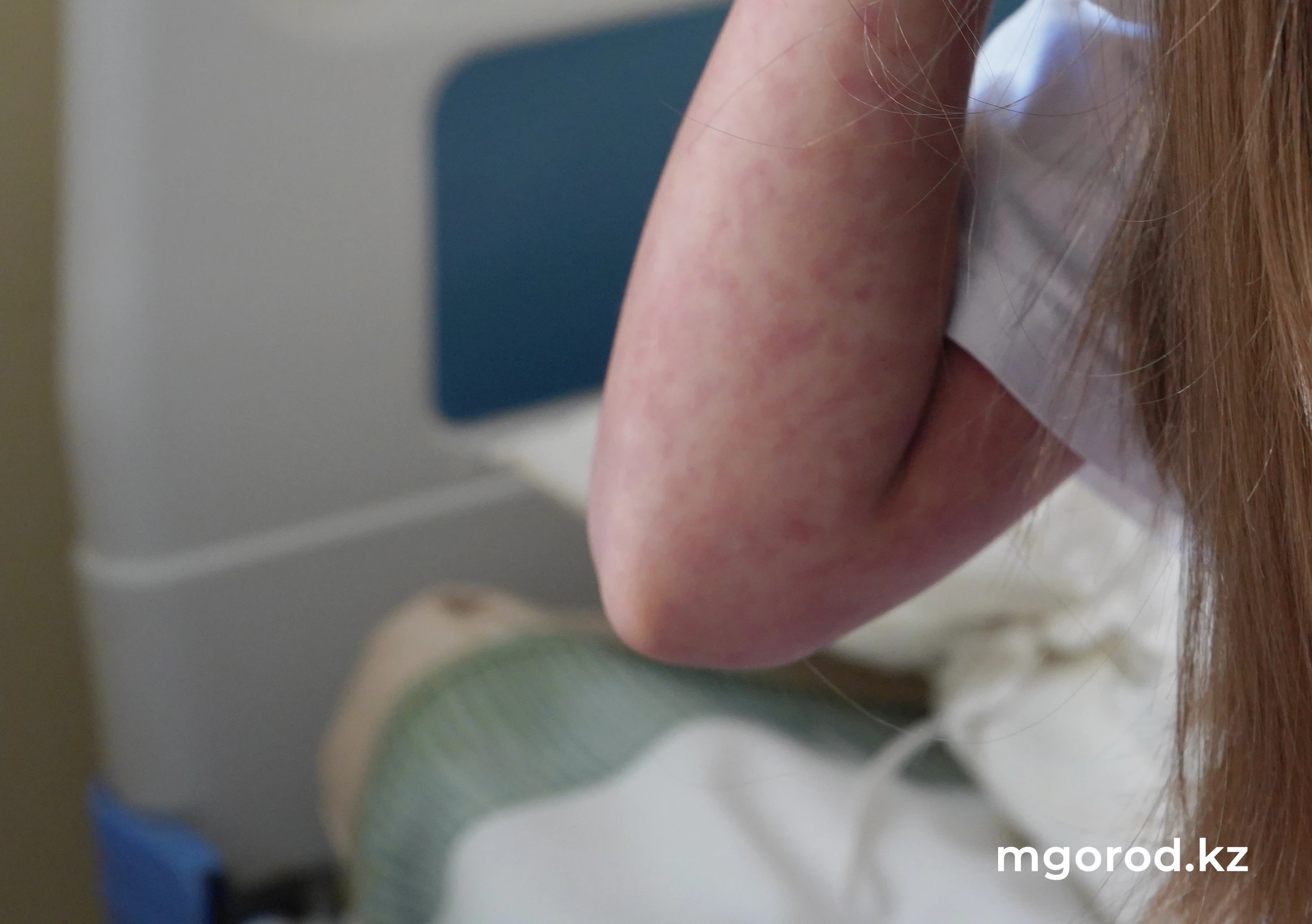 На 99% снизилась заболеваемость корью в Казахстане